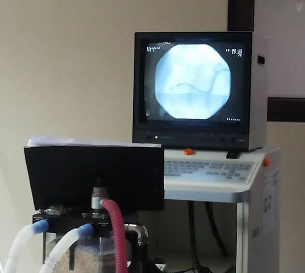 pacemaker