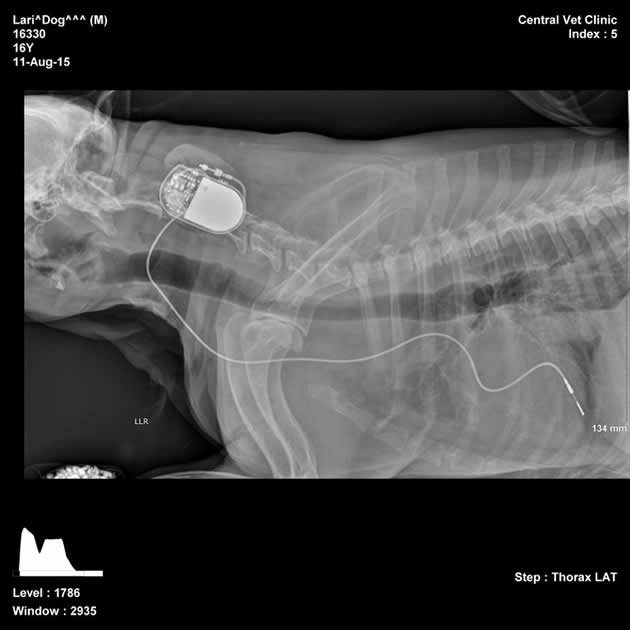 pacemaker